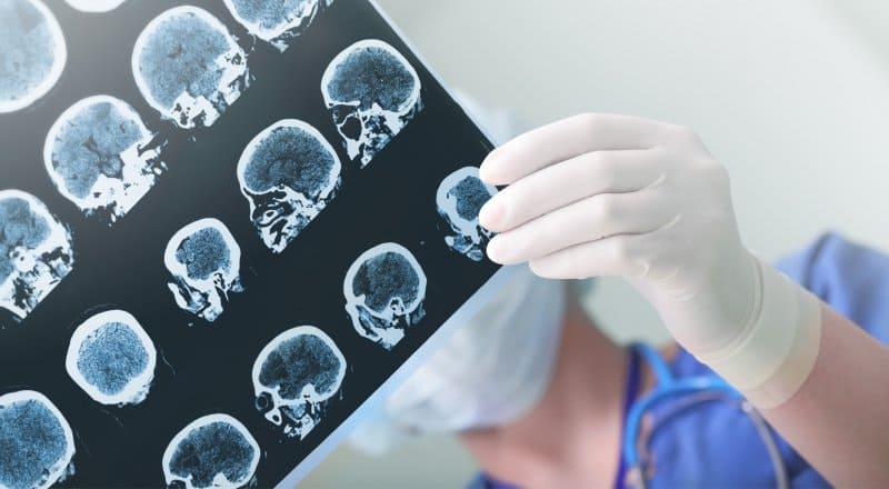 neurologo cerca de mi ubicacion